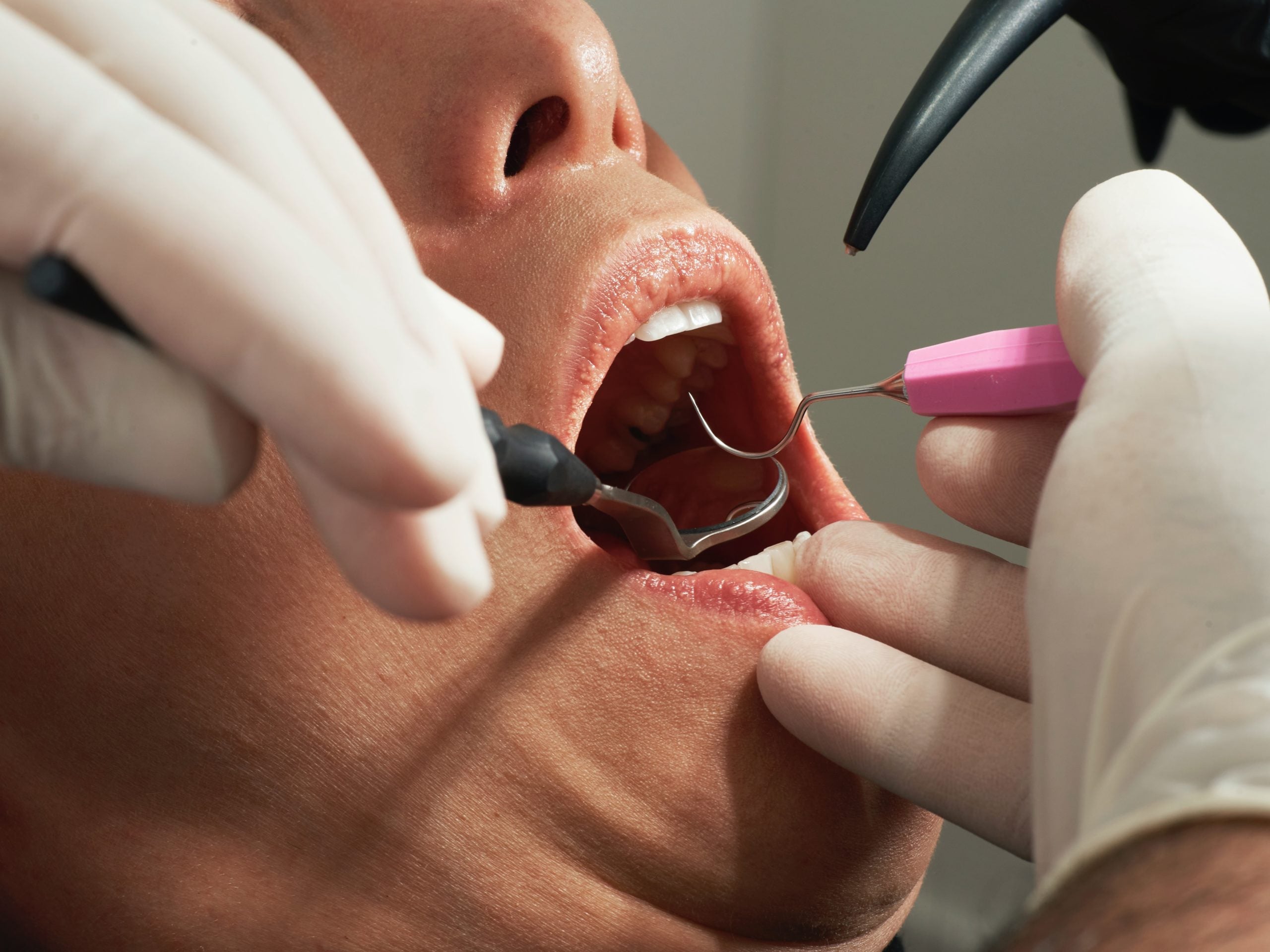 Why You Need to Upgrade Your Dental Instruments & Replace Outdated, Sub-Optimal Tools NOW