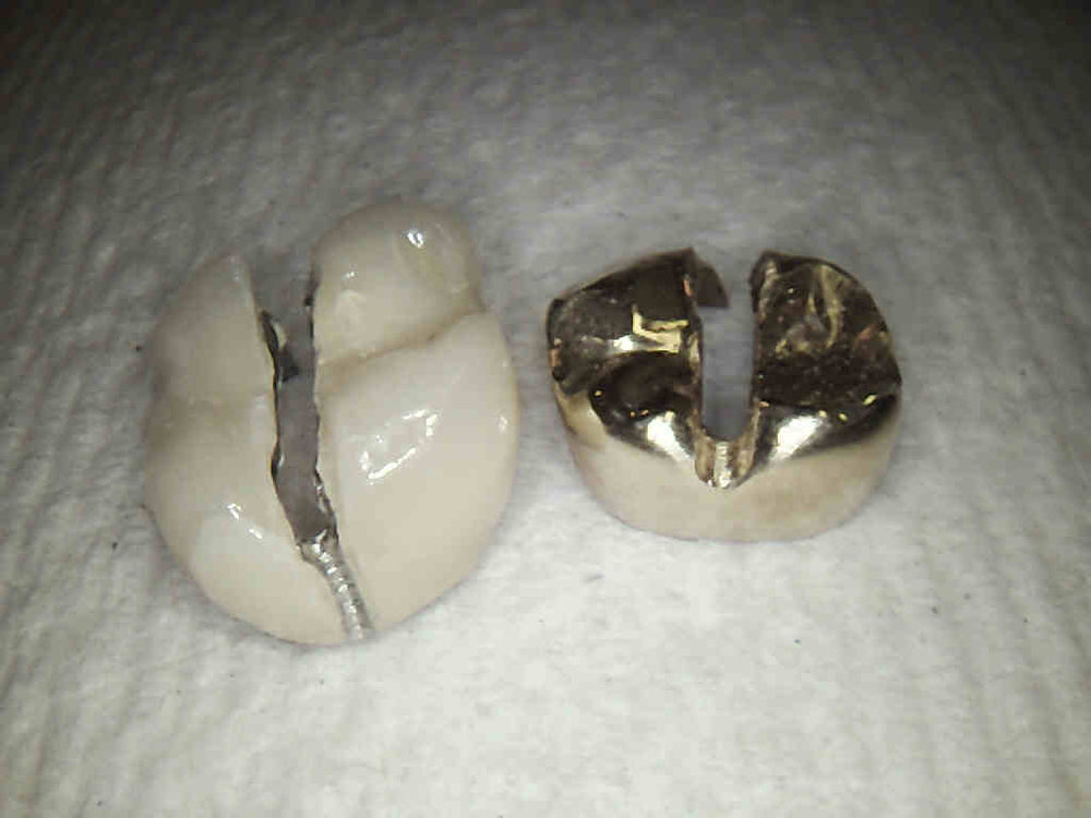 Metal Buster™ Bur | ArtCraft Dental | Best Diamonds and Burs