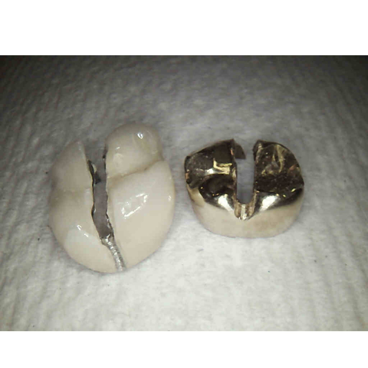 Introducing The Best Crown Remover For 60 Second Removals Max Crown introducing-the-best-crown-remover-for-60-second-removals-max-crown