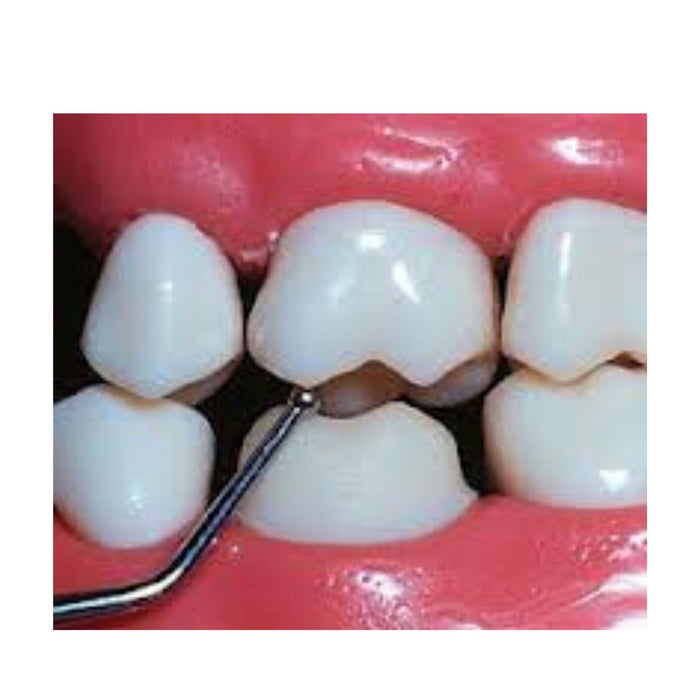 spot-On™ Verifier | ArtCraft Dental, Inc. | Premium Dental Instruments